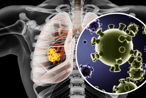 新冠肺炎更名为新冠感染-摄图网